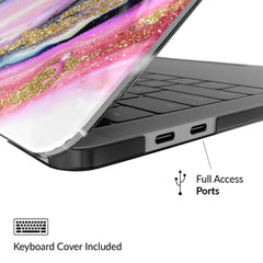 Galaxy Glitter Marble MacBook Case 2.0